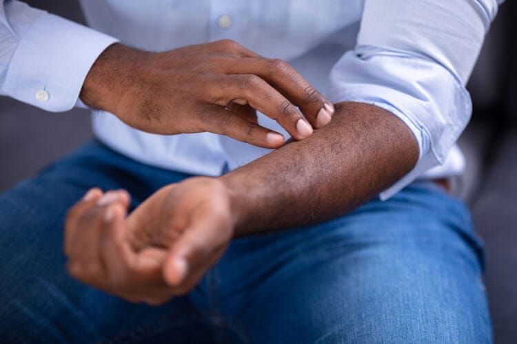 Close-up Of An African Man Scratching His Hand